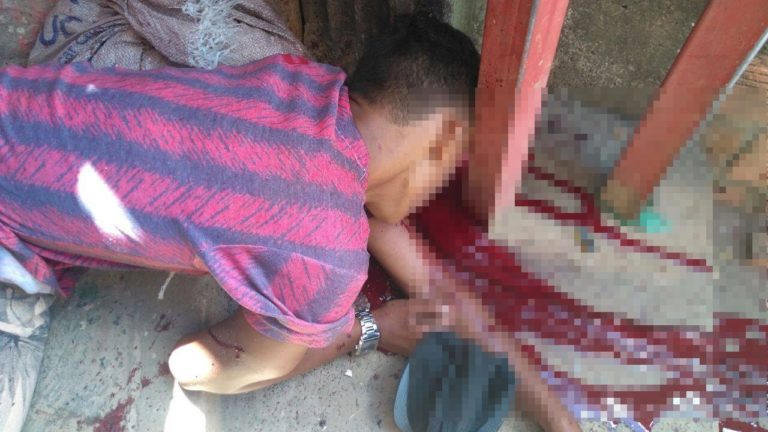 Imagens Fortes: mais um Jovem foi  executado em Pernambués com vários tiros