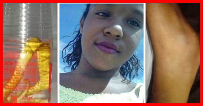 Após ser picada por cobra e liberada de hospital, menina de 12 anos morre