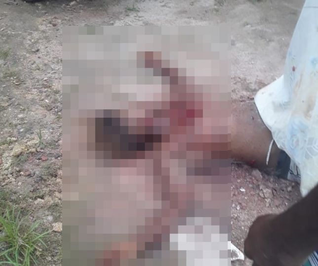 ATENÇÃO! IMAGENS FORTES! Tiro de escopeta abre dois buracos no peito de homem