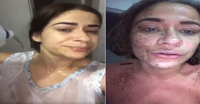 IMAGENS FORTES! MULHER SE AUTOMUTILA ATEANDO FOGO NO PRÓPRIO CORPO APÓS FIM DE RELACIONAMENTO AMOROSO. VEJA VÍDEOS