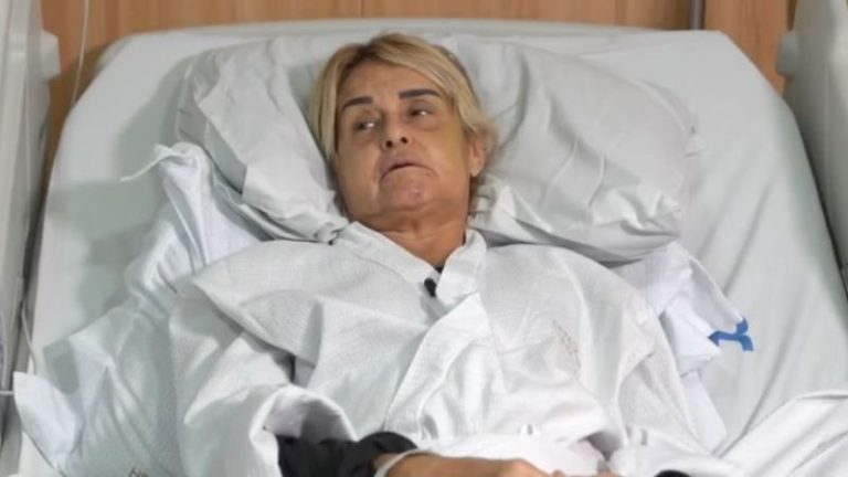 Médica sofre traumatismo craniano após ser espancada e roubada por namorado: “Achei que ia morrer”